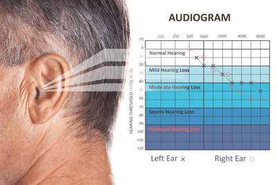 Step 1 - Your Hearing Profile